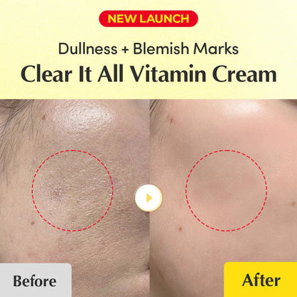 EqqualBerry Vitamin Illuminating Dark Spots Cream